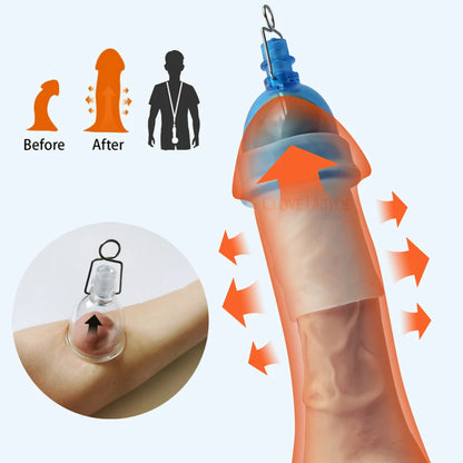 Penis Extender Accessories