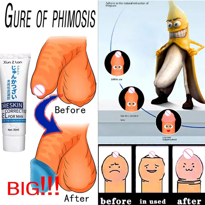 Rapid Treatment Male Redundant